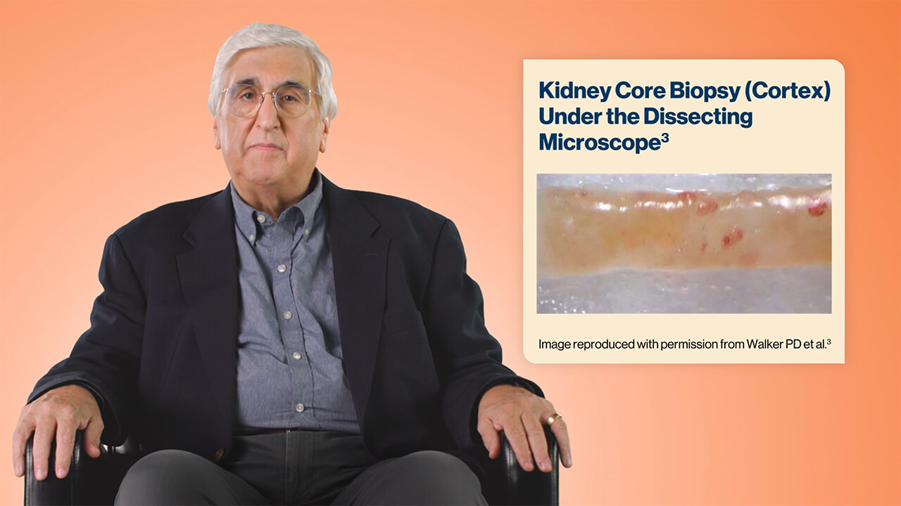 A review of kidney biopsy in CMKDs